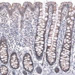 ZSWIM8 Antibody in Immunohistochemistry (Paraffin) (IHC (P))