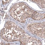 ZSWIM8 Antibody in Immunohistochemistry (Paraffin) (IHC (P))
