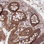 NUDT8 Antibody in Immunohistochemistry (Paraffin) (IHC (P))