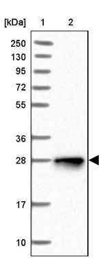 NUDT8 Antibody in Western Blot (WB)