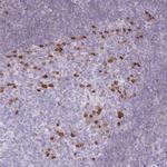 ZBP1 Polyclonal Antibody