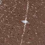 Cerebellin 3 Antibody in Immunohistochemistry (Paraffin) (IHC (P))