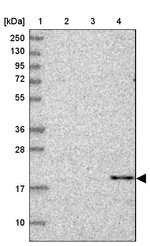 Cerebellin 3 Antibody in Western Blot (WB)