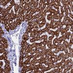 ANKRD29 Polyclonal Antibody