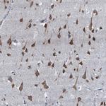 LSM14B Antibody in Immunohistochemistry (Paraffin) (IHC (P))