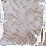 LSM14B Antibody in Immunohistochemistry (Paraffin) (IHC (P))