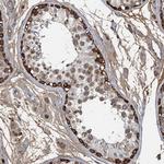 LSM14B Antibody in Immunohistochemistry (Paraffin) (IHC (P))