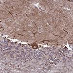 PTCHD4 Antibody in Immunohistochemistry (Paraffin) (IHC (P))