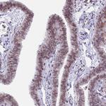 PTCHD4 Antibody in Immunohistochemistry (Paraffin) (IHC (P))