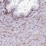 PTCHD4 Polyclonal Antibody