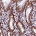 PTCHD4 Antibody in Immunohistochemistry (Paraffin) (IHC (P))