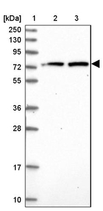 KBTBD8 Antibody in Western Blot (WB)