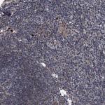 KBTBD8 Polyclonal Antibody