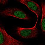 FAM44A Polyclonal Antibody