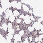 FAM44A Antibody in Immunohistochemistry (Paraffin) (IHC (P))
