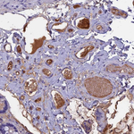 ANGPTL2 Antibody in Immunohistochemistry (Paraffin) (IHC (P))