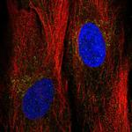 ANGPTL2 Polyclonal Antibody