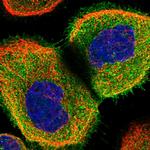 Coronin 2A Polyclonal Antibody