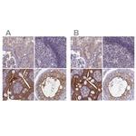 Coronin 2A Antibody in Immunohistochemistry (IHC)