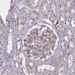 Coronin 2A Antibody in Immunohistochemistry (IHC)