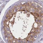 Coronin 2A Antibody in Immunohistochemistry (IHC)