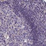 Coronin 2A Antibody in Immunohistochemistry (IHC)