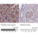 Coronin 2A Antibody