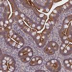 Coronin 2A Antibody in Immunohistochemistry (IHC)