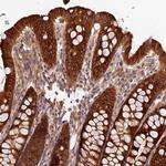 CES3 Antibody in Immunohistochemistry (Paraffin) (IHC (P))