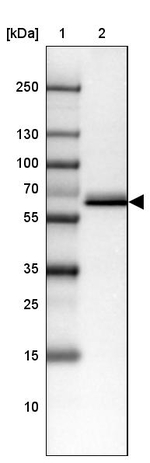 CES3 Antibody in Western Blot (WB)