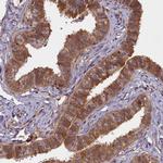 BICD1 Polyclonal Antibody