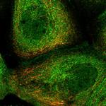 RILPL1 Polyclonal Antibody