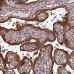 RILPL1 Antibody in Immunohistochemistry (Paraffin) (IHC (P))