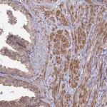 RILPL1 Antibody in Immunohistochemistry (Paraffin) (IHC (P))