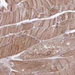 RILPL1 Antibody in Immunohistochemistry (Paraffin) (IHC (P))