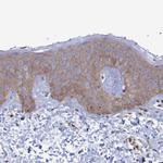 RILPL1 Antibody in Immunohistochemistry (Paraffin) (IHC (P))