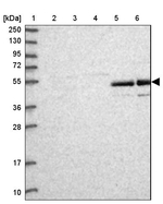 AMDHD2 Antibody in Western Blot (WB)