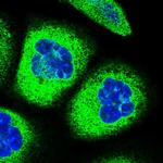 CYP51A1 Polyclonal Antibody