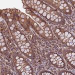 SLC9A5 Antibody in Immunohistochemistry (Paraffin) (IHC (P))