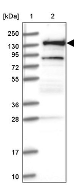 RNF40 Antibody in Western Blot (WB)