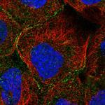 MTHFSD Polyclonal Antibody