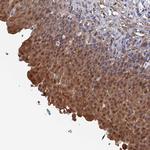 MTHFSD Antibody in Immunohistochemistry (Paraffin) (IHC (P))