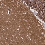 FXYD6 Antibody in Immunohistochemistry (Paraffin) (IHC (P))