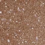 FXYD6 Antibody in Immunohistochemistry (Paraffin) (IHC (P))