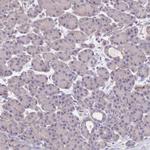 FXYD6 Antibody in Immunohistochemistry (Paraffin) (IHC (P))