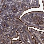 C10orf47 Polyclonal Antibody