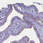 Rotatin Antibody in Immunohistochemistry (Paraffin) (IHC (P))