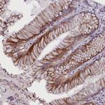 Rotatin Antibody in Immunohistochemistry (Paraffin) (IHC (P))