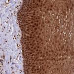 DHX38 Antibody in Immunohistochemistry (Paraffin) (IHC (P))