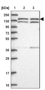 DHX38 Antibody in Western Blot (WB)